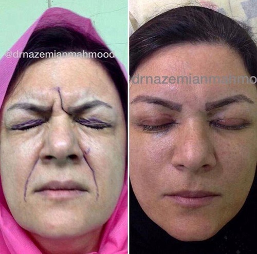 دکتر محمود ناظمیان – فوق تخصص جراحی پلاستیک و زیبایی دکتر محمود ناظمیان – فوق تخصص جراحی پلاستیک و زیبایی