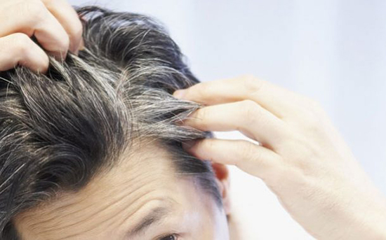 نسخه تقویت مو‌ها از مسیر مزاج‌شناسی